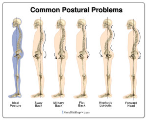 Bad-Postures