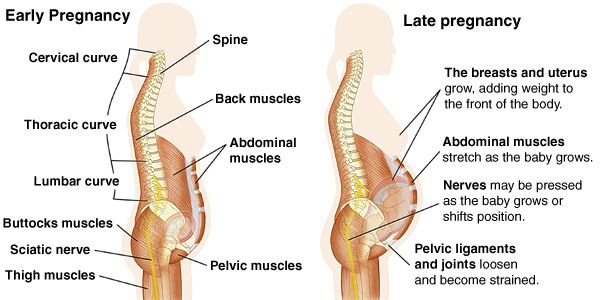 Sciatica & Trapped Nerves  The Backbone Osteopath Southgate